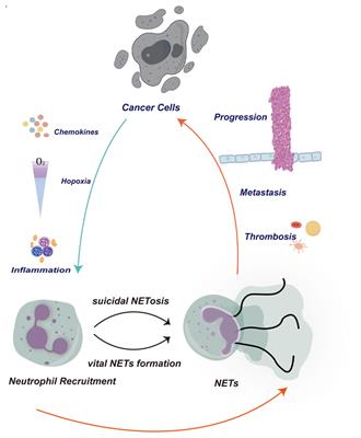 Neutrophil extracellular traps in tumor progression of gynecologic cancers